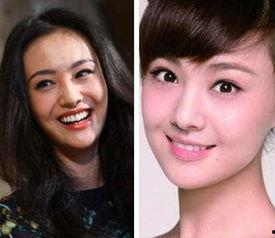 美国整容失败的明星,盘点那些美梦破碎的明星