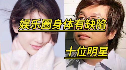 娱乐圈身体有缺陷,娱乐圈身体有缺陷的明星风采